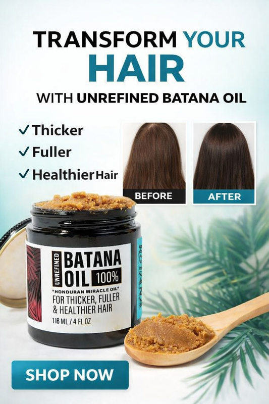Anti hair loss,hair Regrowth kavix Bantana Oil Cream 2.0