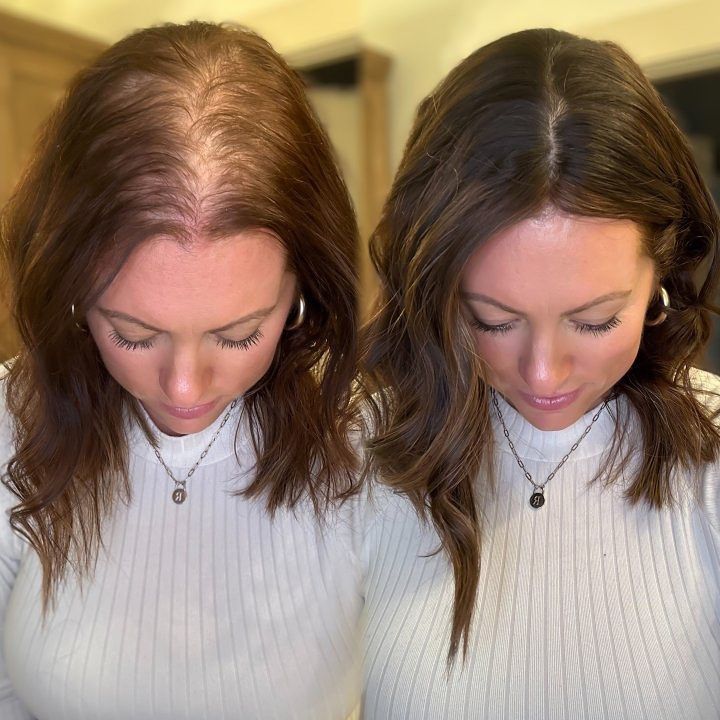 Anti hair loss,hair Regrowth kavix Bantana Oil Cream 2.0