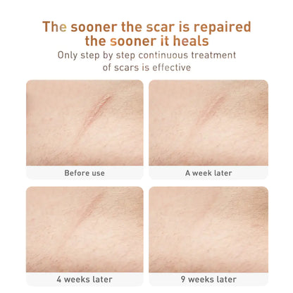 Scar Gel ,Acne ,Stretch Marks & Skin Repair AND REJUVENATION