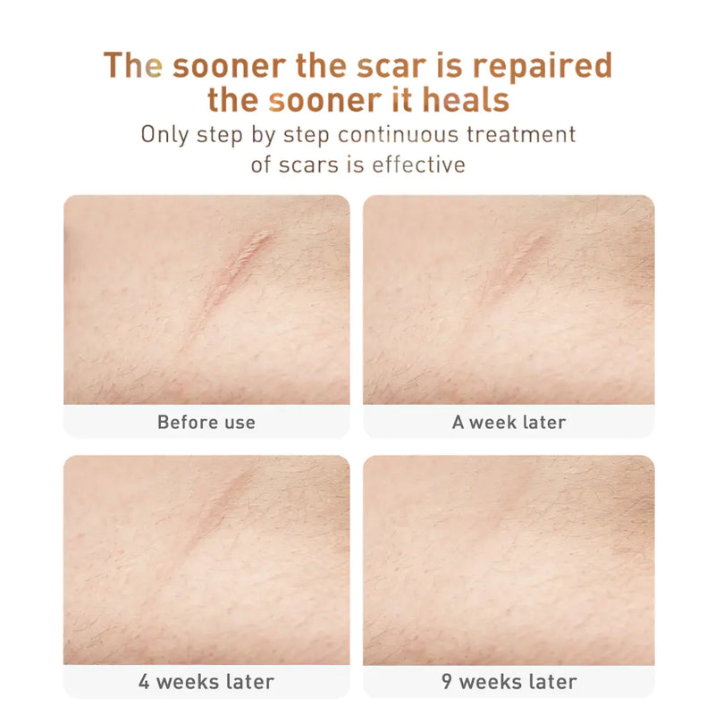 Scar Gel ,Acne ,Stretch Marks & Skin Repair AND REJUVENATION