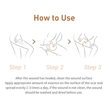 Scar Gel ,Acne ,Stretch Marks & Skin Repair AND REJUVENATION