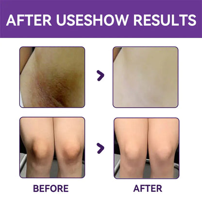 Tender Red Pigment and Cream for Skin Repair